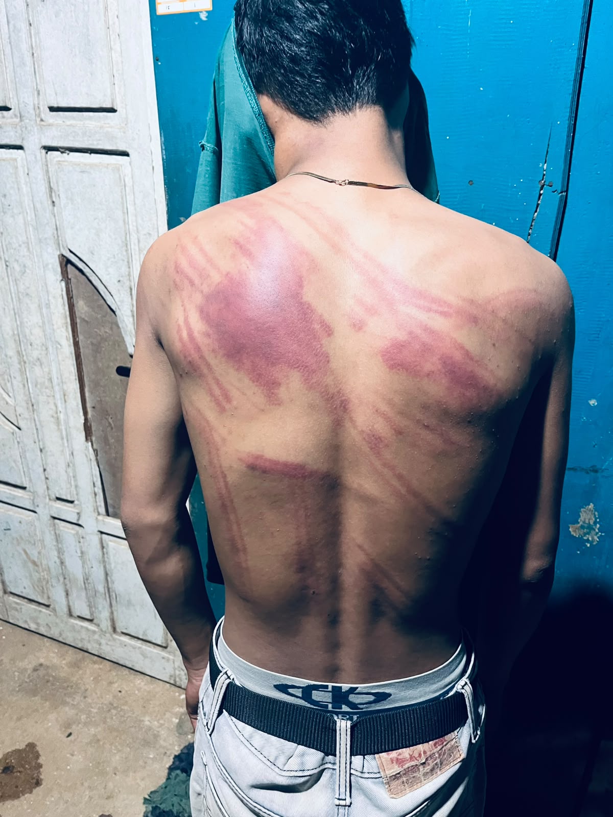 Dugaan Kekerasan Terhadap MF di Kolaka: Prof. Sutan Nasomal Minta Usut Terang-Terang